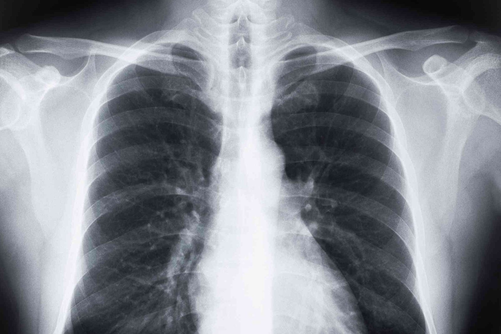 Vape Lung Risk UAE