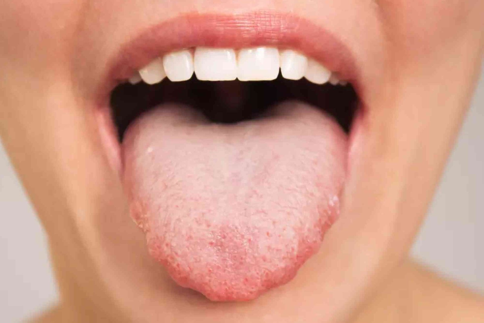 Vaper's Tongue Remedies